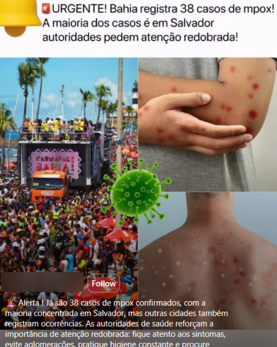 Doença mpox sintomas: como reconhecer, transmitir e agir