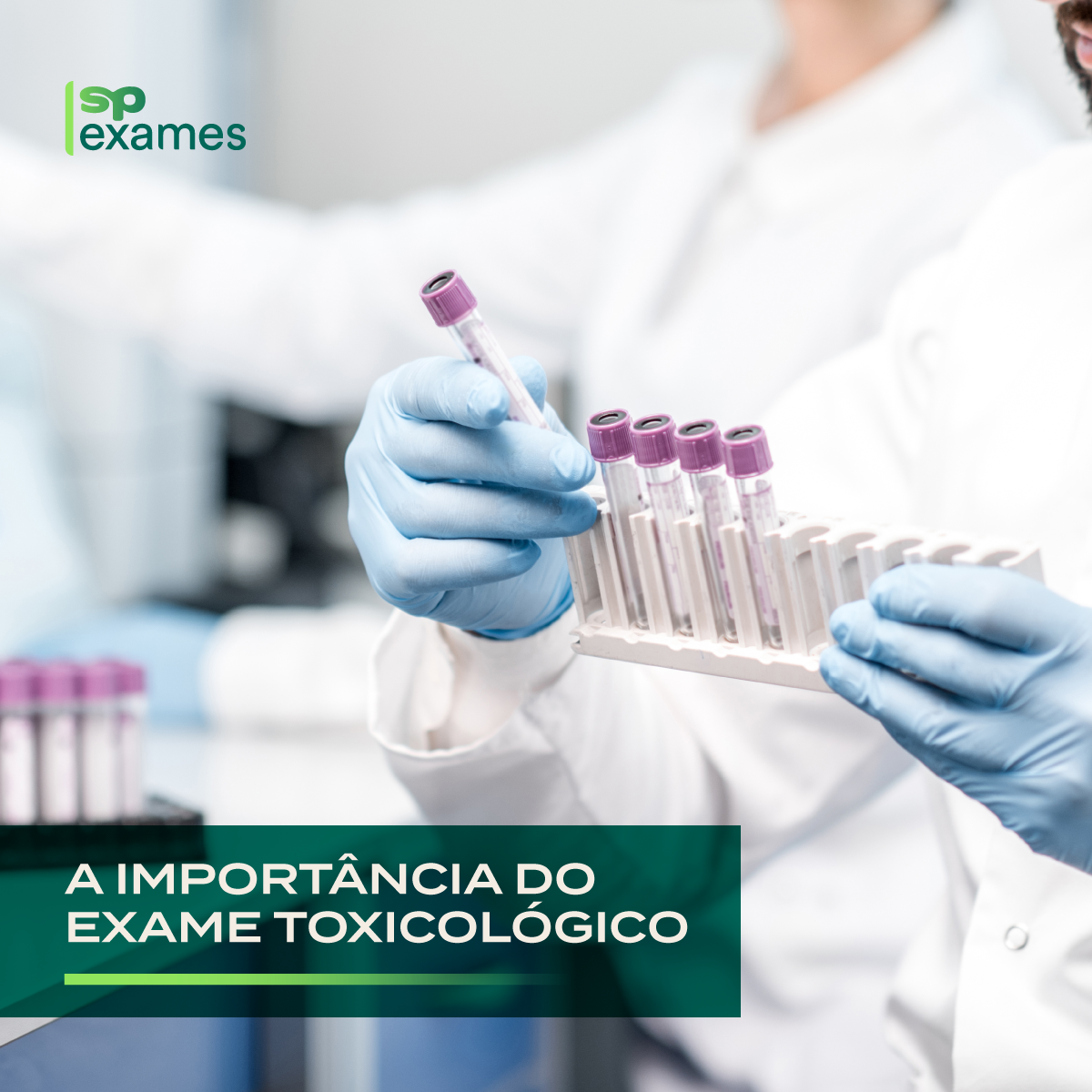 O que é e como funciona o exame toxicológico no Brasil